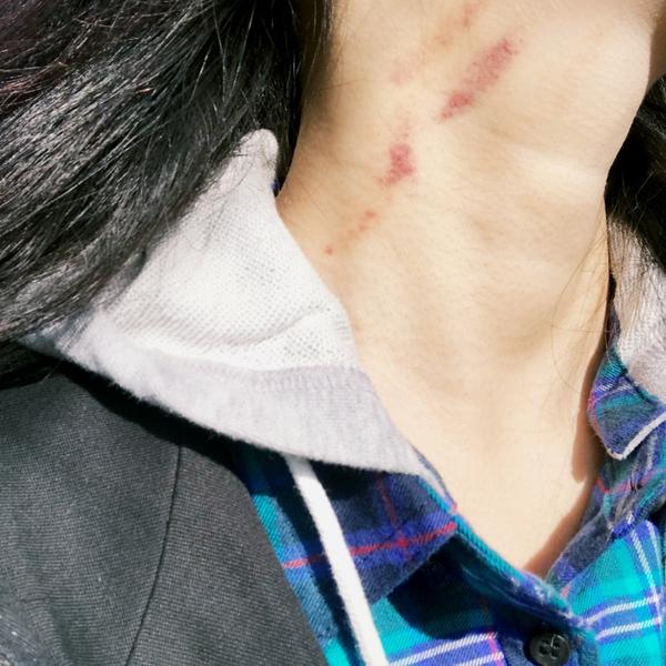女生有喉结是一种怎样的体验?
