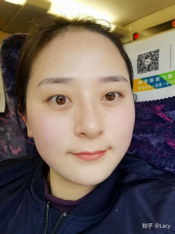 甲亢眼突治疗?
