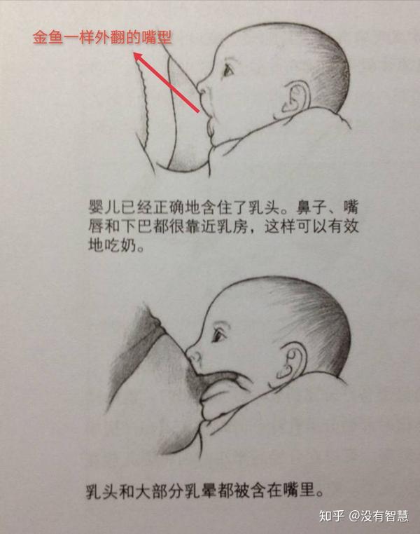 新生儿喂奶时妈妈用手轻轻压下巴,翻嘴唇,帮助形成正确姿势.