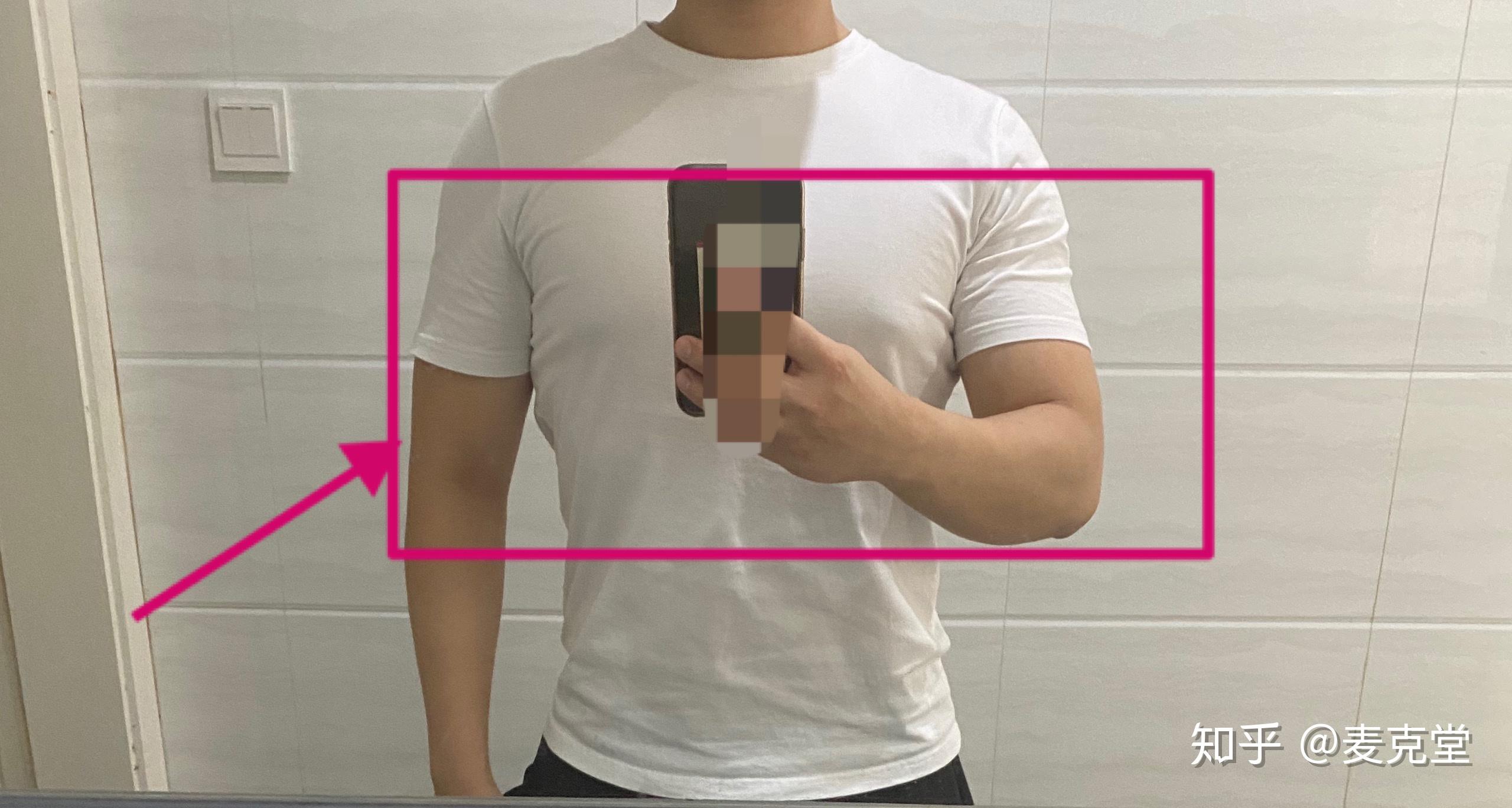 男生胸部脂肪过多胸部雌化的穿衣激凸问题通过定制t恤从外部修饰