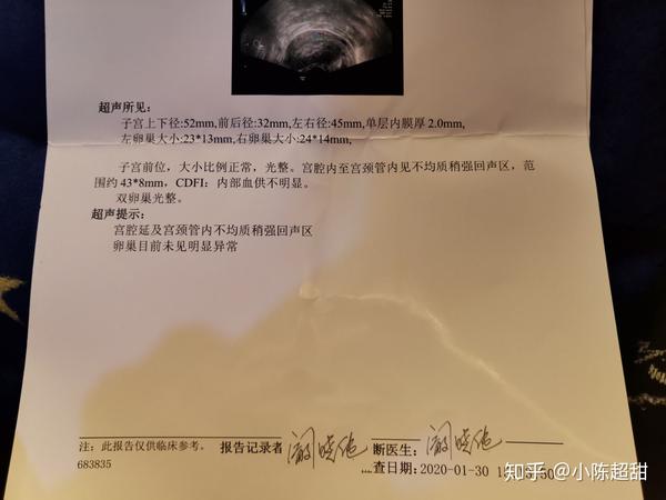 药流大残留 未清宫到无残留