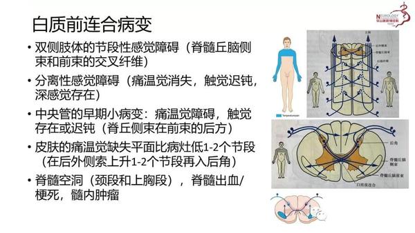 炎 婴儿性肌萎缩症 乙型脑脊髓炎 进行性脊肌萎缩症(运动神经元病)