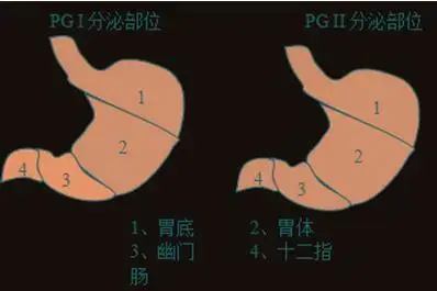 胃不舒服,与胃相关的检查有哪些?一分钟看懂这些重要检查项目