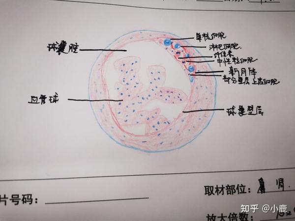 部分病理学切片红蓝铅笔手绘图,画的有一点点丑