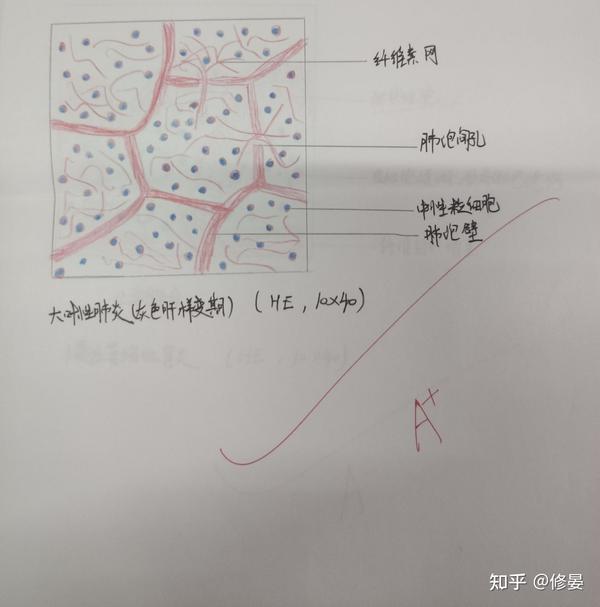 病理切片红蓝铅笔绘图