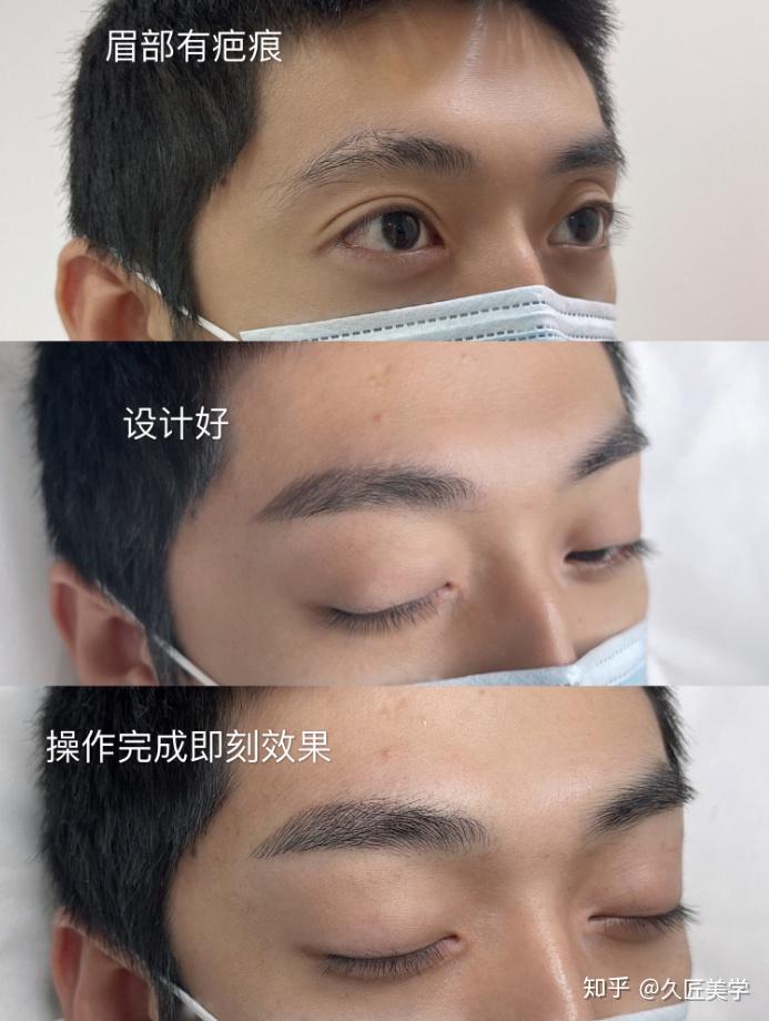 男士半永久纹眉我不娘我很man