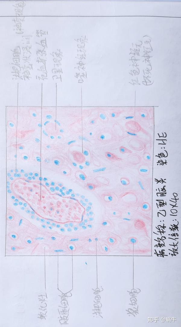 病理红蓝铅笔绘图临床大二