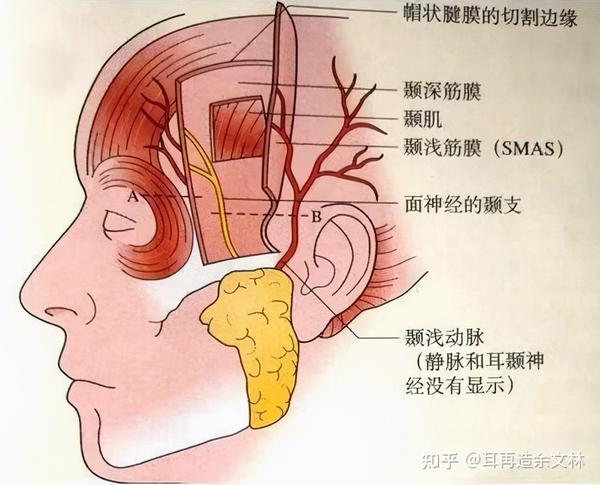 为什么要用颞浅筋膜瓣覆盖耳支架?