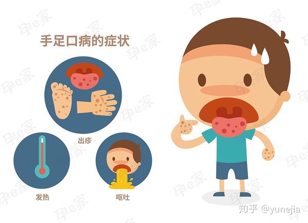 手足口病正高发!宝宝有这4种情况请马上就医!