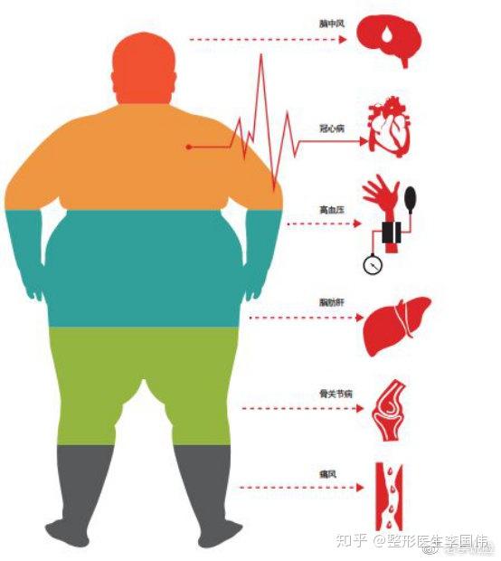 61肥胖引起心血管病变