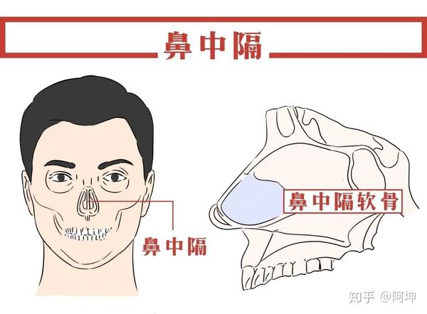 鼻中隔软骨有什么优缺点?