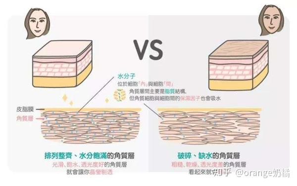 角质层太薄会造成皮肤 敏感干燥,脱水脱皮,角质层太厚容易堆积,会造成