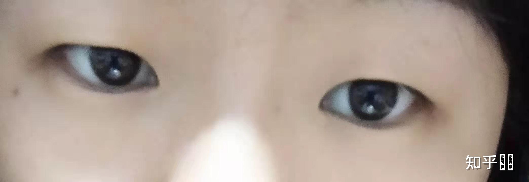 怎样判断自己的眼型
