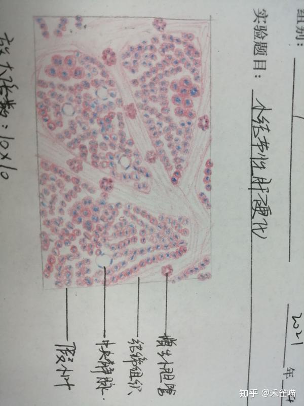 组胚学与病理学实验红蓝铅笔报告册