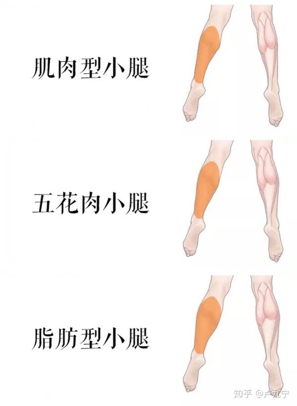 使腓肠肌肌肉失去神经支配而萎缩,体积缩小从而达到瘦小腿的目的