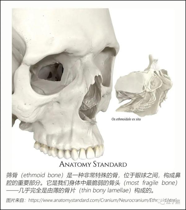 首先找到筛骨在颅前窝中的相对位置