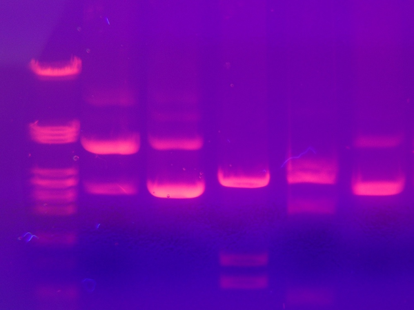 凝胶电泳是一种用于分离 dna 分子(主要是在法医中)的常用技术,该技术