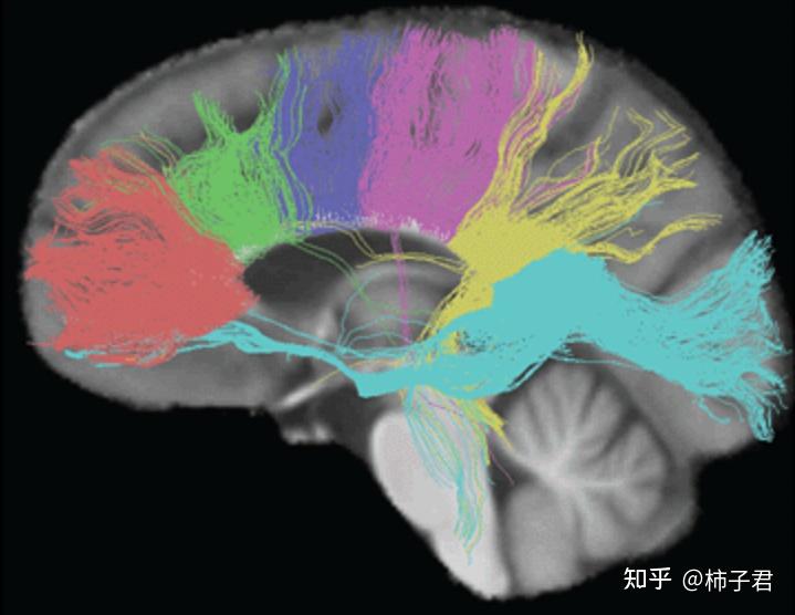 三,胼胝体(corpus callosum[2]