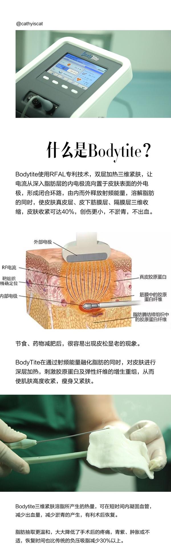 面部吸脂也做过,做的最新的bodytite.上几张整容日记恢复图.