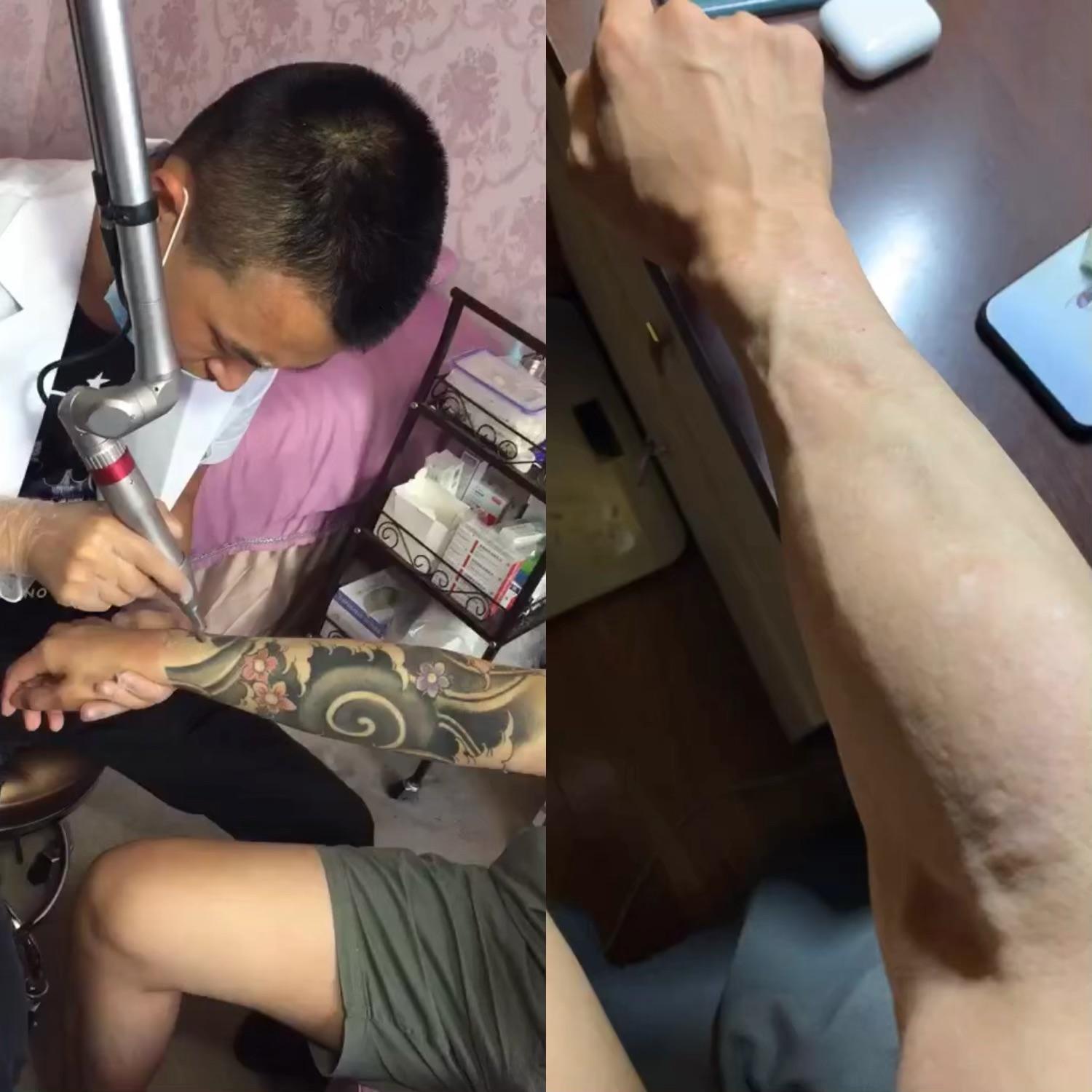 com/video/1259781837704617984 目前纹身我们可以完全洗干净,接近