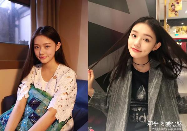 林允最新路拍照丑哭路人整牙之后老10岁所以鲶鱼脸都是这么不抗老么