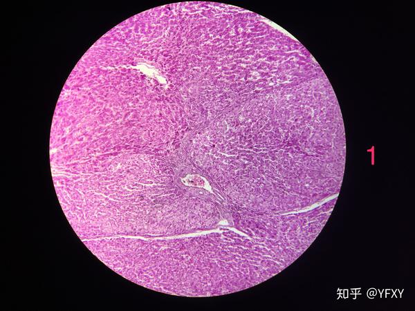 病理学 红蓝铅笔绘图