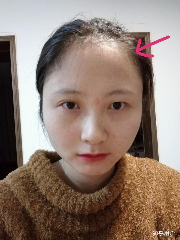 女生长得难看怎么办?