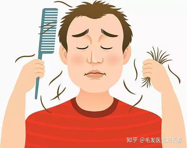 如何判断自己是否是脂溢性脱发