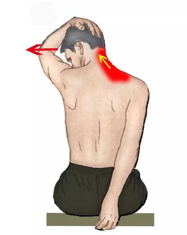 1,拉伸肩胛提肌,胸锁乳突肌