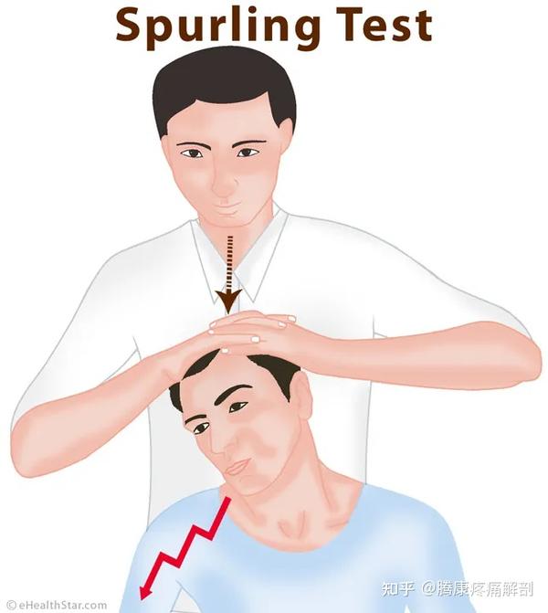 椎间孔挤压试验(左右)患者取坐位,检查者站在其身后,一只手置于患者