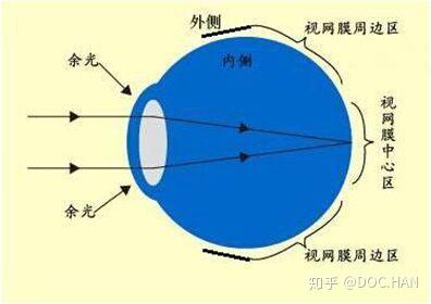 真假性近视是不是不可逆的?