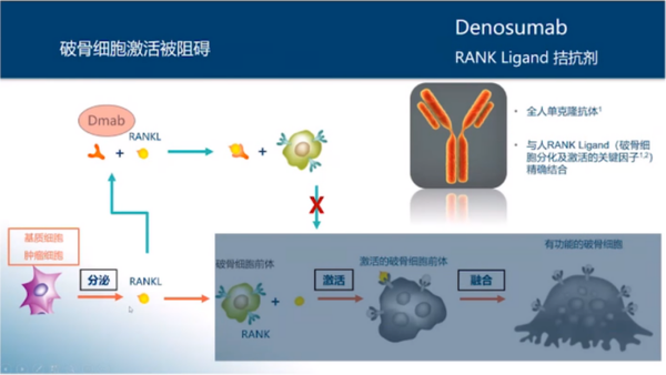 百济神州地舒单抗获批实体瘤骨转移