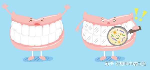 "),基托,人工牙,支托组成,其原理是通过卡环"钩住"剩余牙齿来稳定假牙