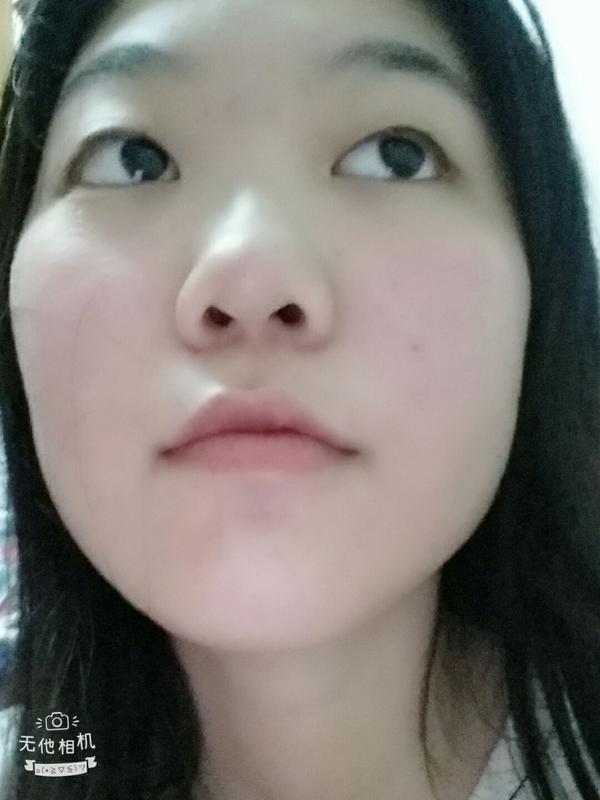 鼻子丑毁了整张脸是什么体验?