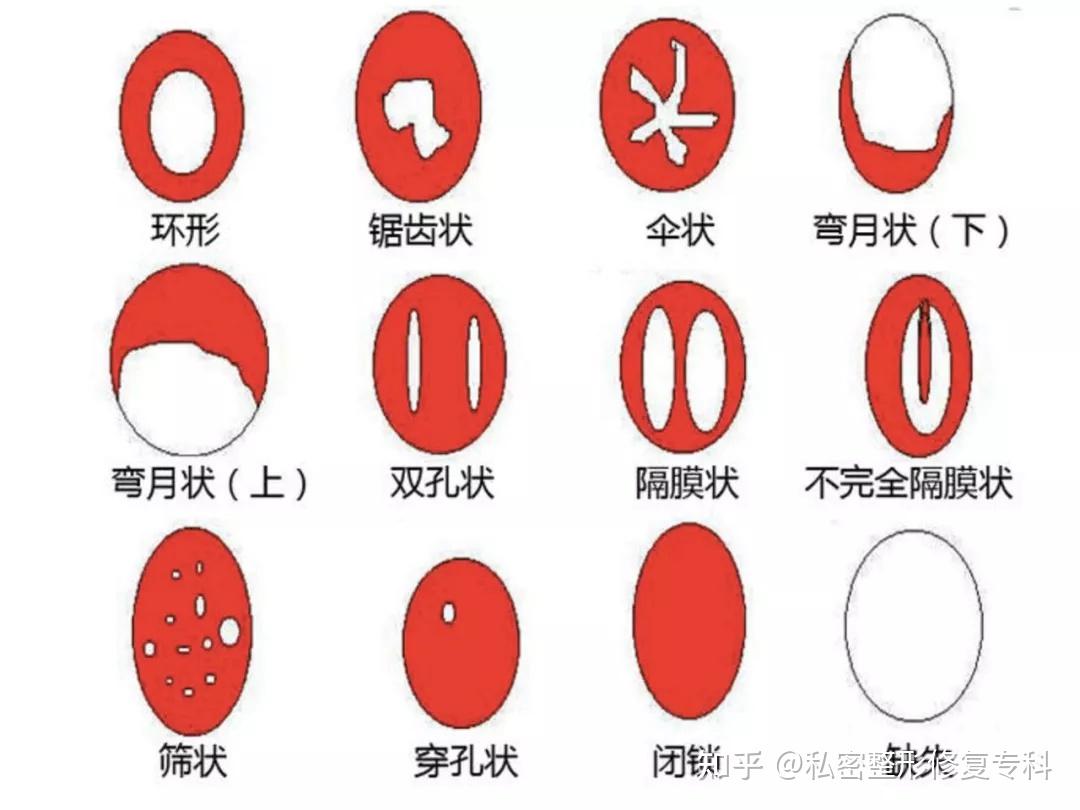 第一次真的会落红咱就别再给处女膜加戏了