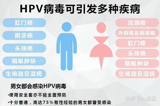 男性感染hpv阳性症状有哪些?