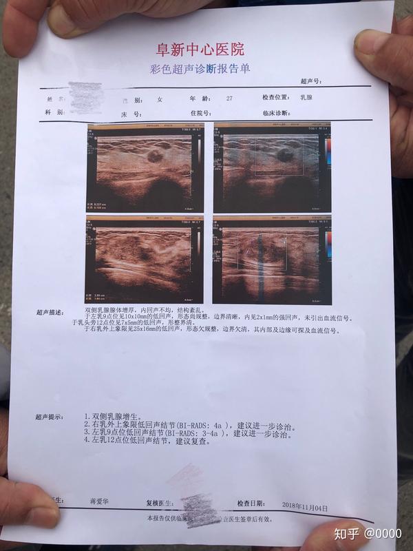 乳腺结节手术 - 知乎