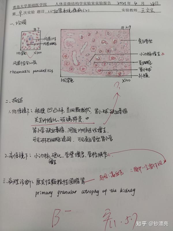 9.心血管系统疾病(2)——原发性颗粒性固缩肾