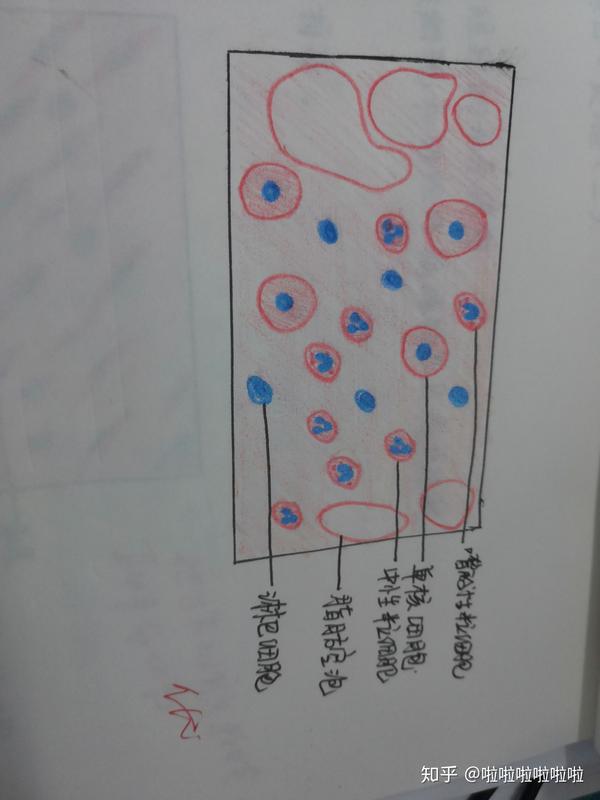 病理学切片红蓝铅笔画