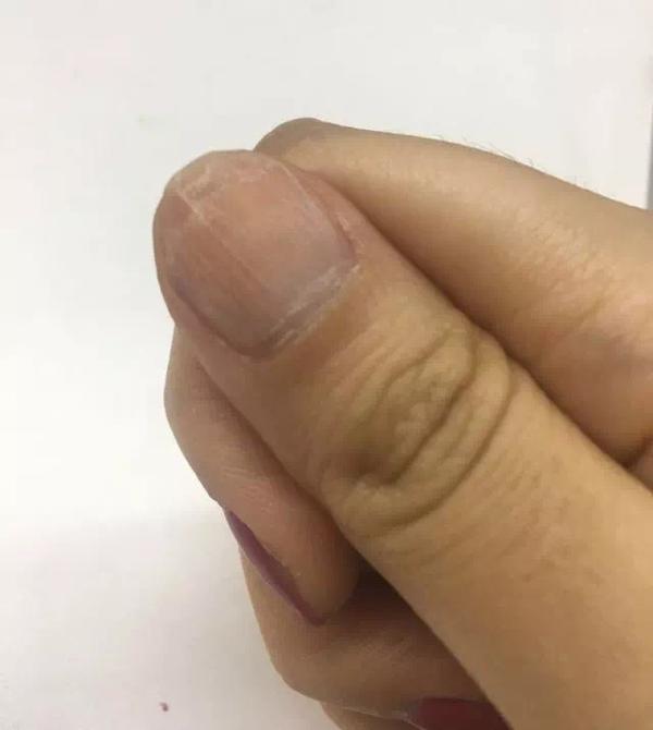 我是每周都换美甲,连续半年,太过频繁的美甲导致我的指甲出现了断层