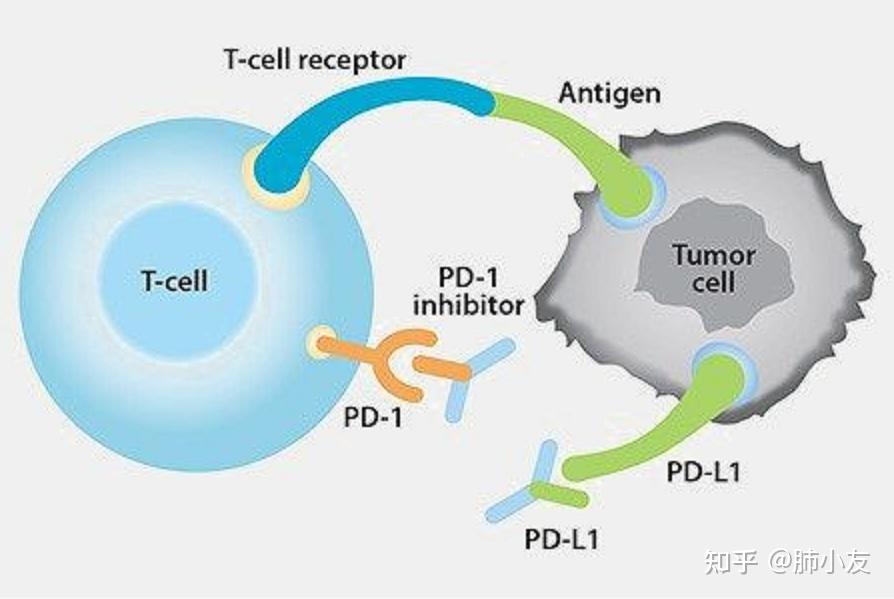 又一pd1抑制剂获批pd1和pdl1哪个疗效更好