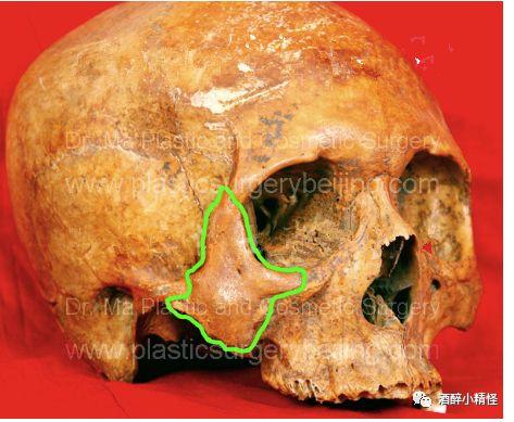 它不是一块平面的骨头,虽是一块扁骨,却有立体维度,在面部正面,侧面均