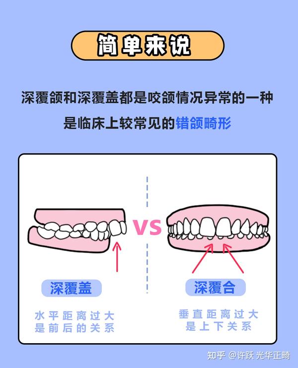 深覆合和深覆盖如何区别有什么影响怎么改善