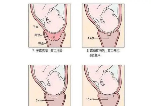 如何检查开了"几指"