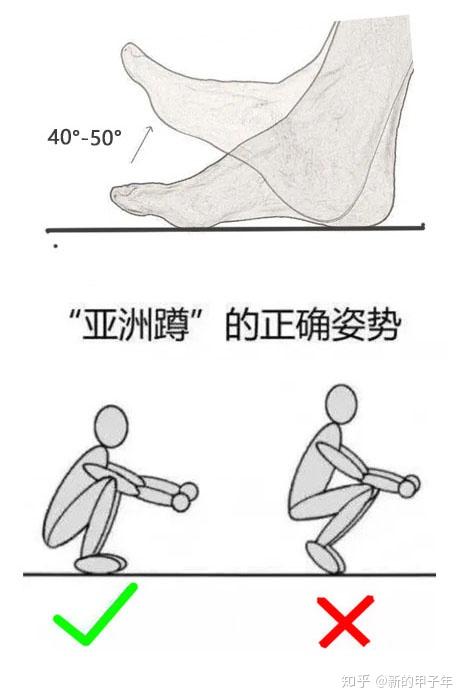 "亚洲蹲"是要求足背屈有正常的活动度的,如果没有,就会出现后脚跟提起