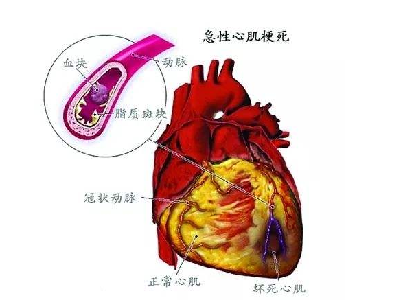正常冠状动脉分为左冠状动脉和右冠状动脉,前者又分为前降支和