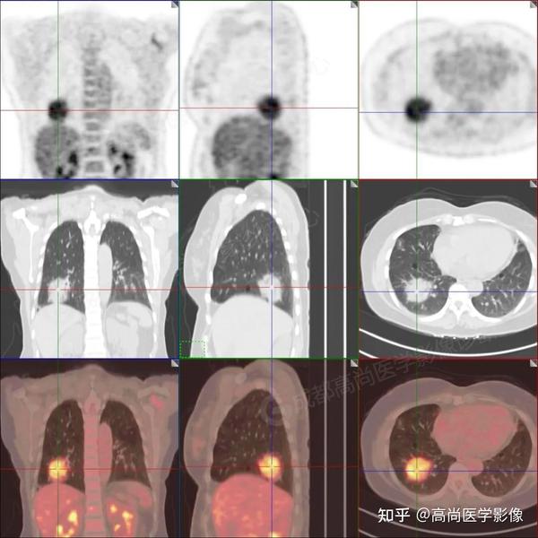 Pet Ct Malt