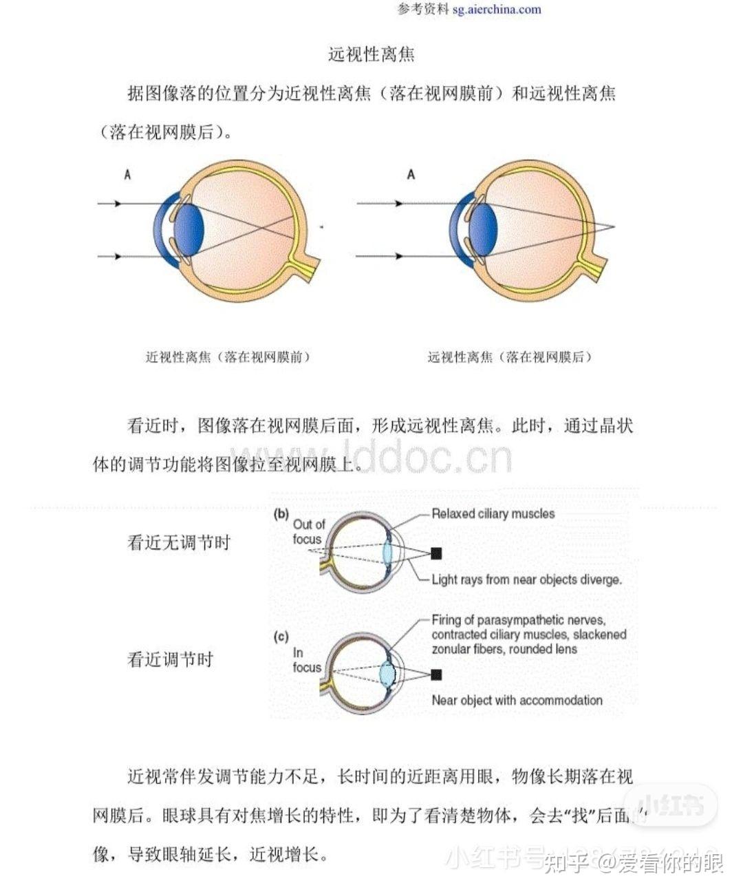 这些镜片,设计有些区别,但基本原理是一样的: 就是把中央光线焦点