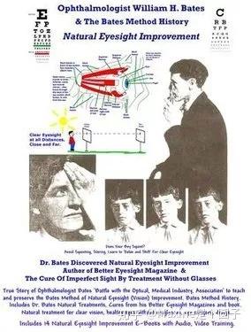 国外也有"眼保健操,名曰"贝茨疗法(bates method.