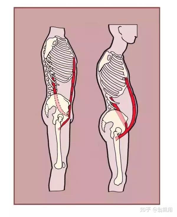 是【翘臀】还是【骨盆前倾】?